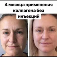 📸 ОТЗЫВЫ❗️20 / КОЛЛАГЕН/ COLLAGEN NL фото/ отзывы 🔴