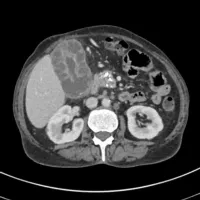 Radiology short cases