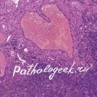 Pathologeek